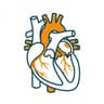 Bypass Surgery (CABG)