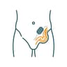Hernia Repair