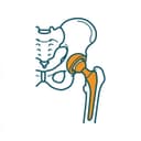 Hip Replacement
