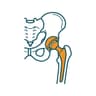 Hip Replacement