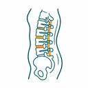 Spine Surgery