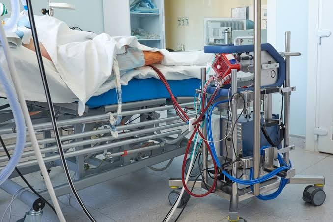 ECMO Support