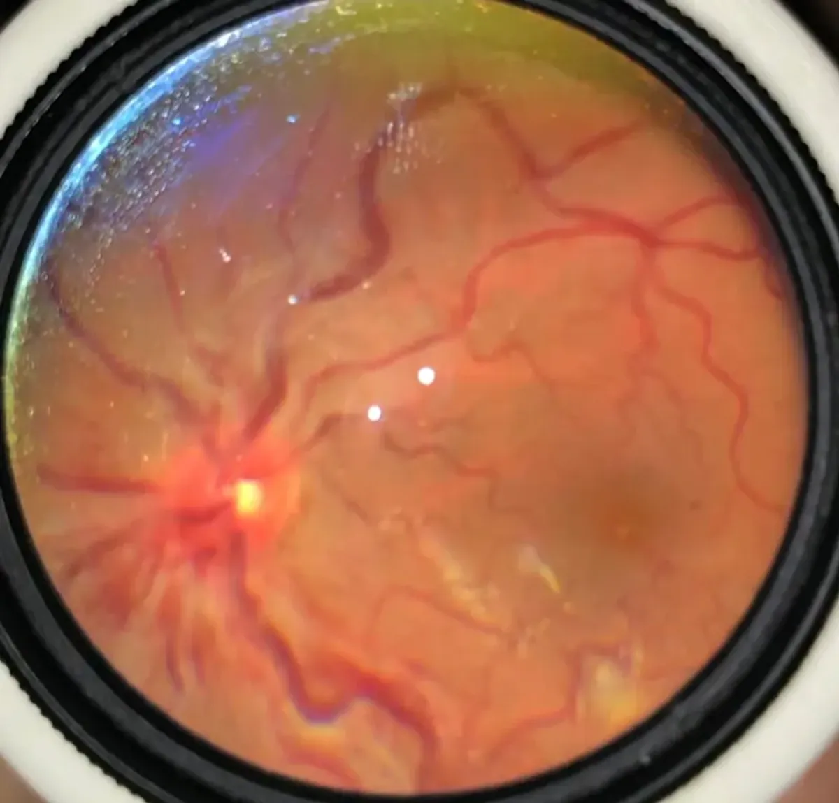 Dr Kp's Eye Care Centre